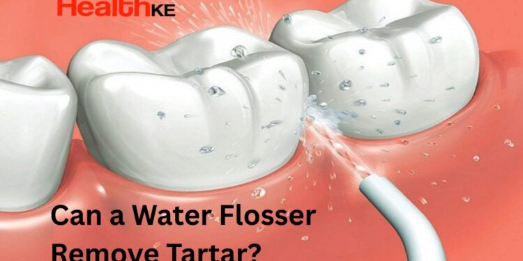 Can a Water Flosser Remove Tartar?