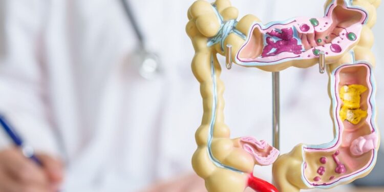 Colorectal Health