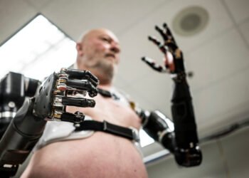 Modern Prosthetic Technology