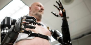 Modern Prosthetic Technology