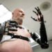 Modern Prosthetic Technology