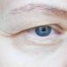When Tired-Looking Eyes Are Actually a Structural Problem