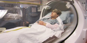 Hyperbaric Oxygen Therapy in Dubai