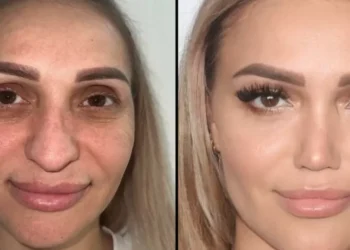 Plastic Surgery Turkey: How to Choose a Suitable Treatment and a Medical Center