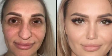 Plastic Surgery Turkey: How to Choose a Suitable Treatment and a Medical Center