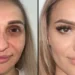 Plastic Surgery Turkey: How to Choose a Suitable Treatment and a Medical Center