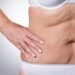 Recovering From Liposuction in Dubai's Climate: What Generic Advice Misses